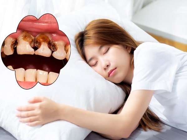 Nằm mơ thấy bị sâu răng là điềm gì tốt hay xấu, số gì may